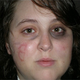 Image for article titled Ashley Todd: An Image Of Intolerance, Illness Or Both?